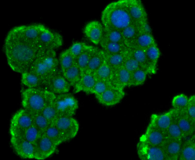 ICC staining MSI2 in PC-12 cells (green). The nuclear counter stain is DAPI (blue). Cells were fixed in paraformaldehyde, permeabilised with 0.25% Triton X100/PBS.