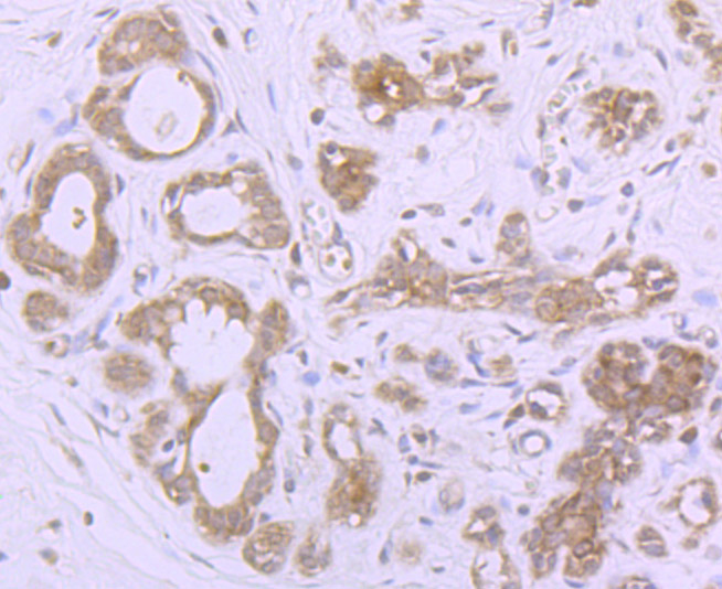Immunohistochemical analysis of paraffin-embedded human breast tissue using anti-MSI2 antibody. Counter stained with hematoxylin.