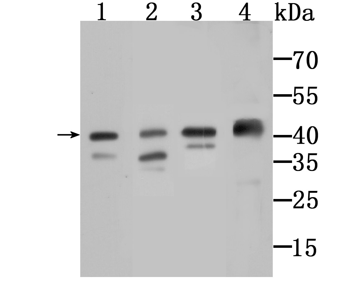 Western blot analysis of AMACR on different lysates using anti-AMACR antibody at 1/1,000 dilution.<br />
 Positive control:<br />
 Lane 1: Mouse liver tissue <br />
    Lane 2: SiHa<br />
 Lane 3: SW480<br />
    Lane 4: Human kidney tissue