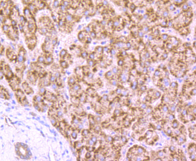 Immunohistochemical analysis of paraffin-embedded human liver tissue using anti-AMACR antibody. Counter stained with hematoxylin.