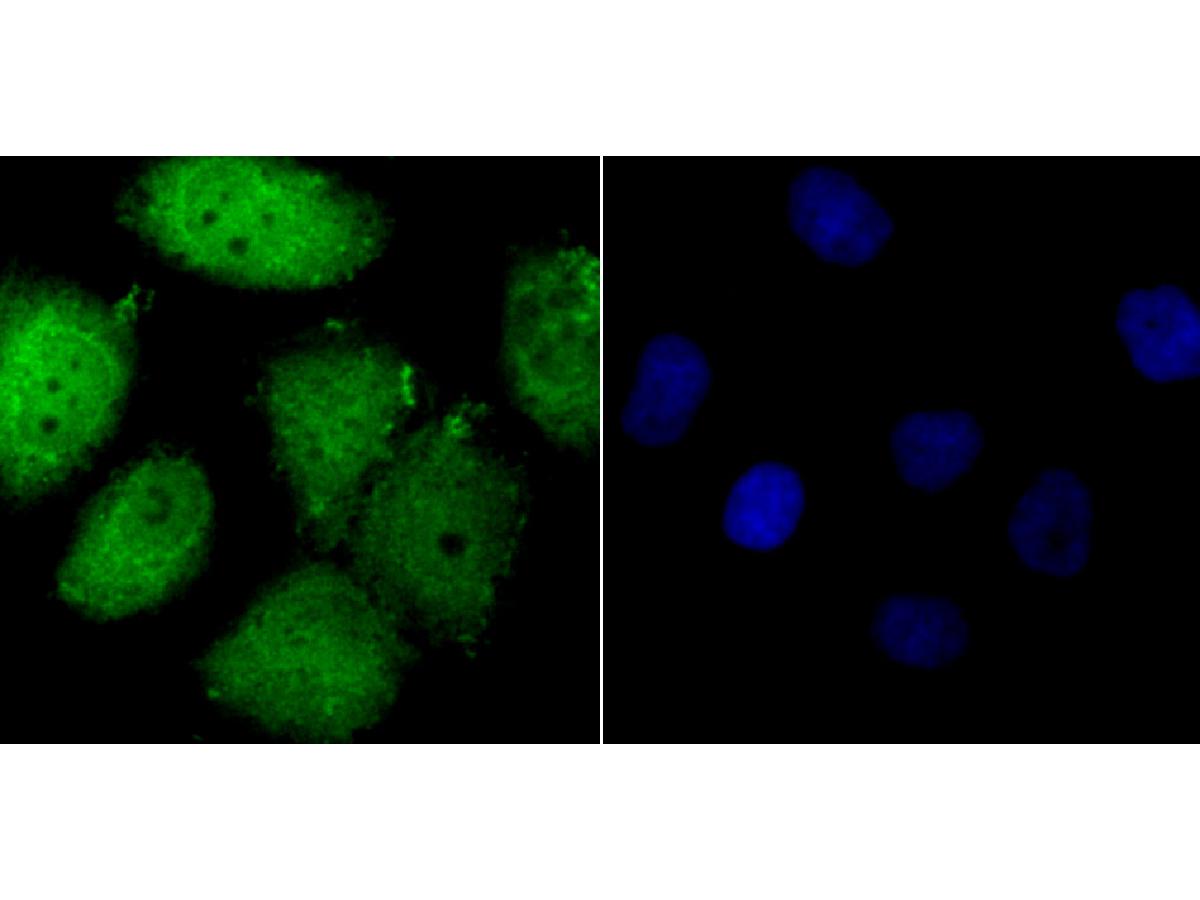 ICC staining FOXM1 in HUVEC cells (green). The nuclear counter stain is DAPI (blue). Cells were fixed in paraformaldehyde, permeabilised with 0.25% Triton X100/PBS.