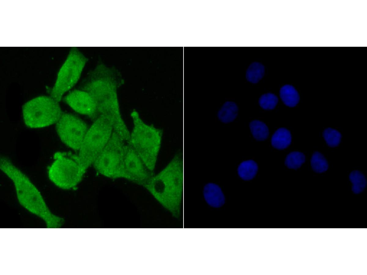 ICC staining FOXM1 in LOVO cells (green). The nuclear counter stain is DAPI (blue). Cells were fixed in paraformaldehyde, permeabilised with 0.25% Triton X100/PBS.