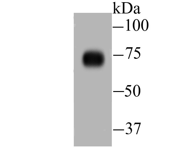 Western blot analysis of DLL4 on human lung tissue lysate using anti-DLL4 antibody at 1/500 dilution.