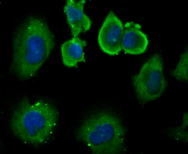 ICC staining DLL4 in HUVEC cells (green). The nuclear counter stain is DAPI (blue). Cells were fixed in paraformaldehyde, permeabilised with 0.25% Triton X100/PBS.