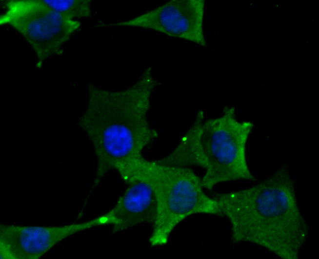 ICC staining DLL4 in PMVEC cells (green). The nuclear counter stain is DAPI (blue). Cells were fixed in paraformaldehyde, permeabilised with 0.25% Triton X100/PBS.