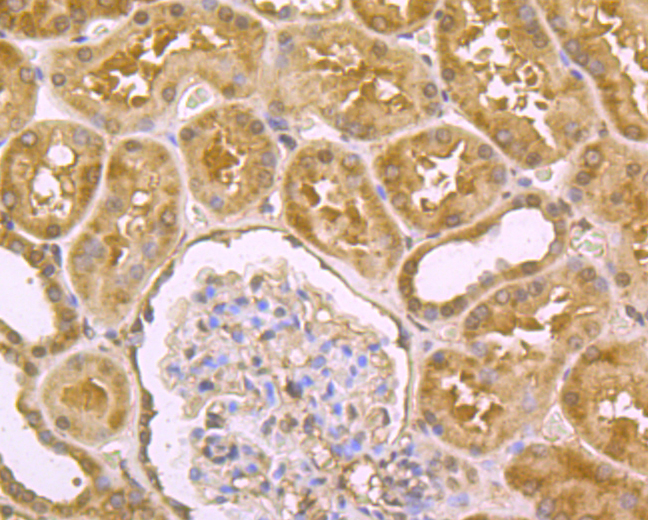Immunohistochemical analysis of paraffin-embedded human kidney tissue using anti-DLL4 antibody. Counter stained with hematoxylin.