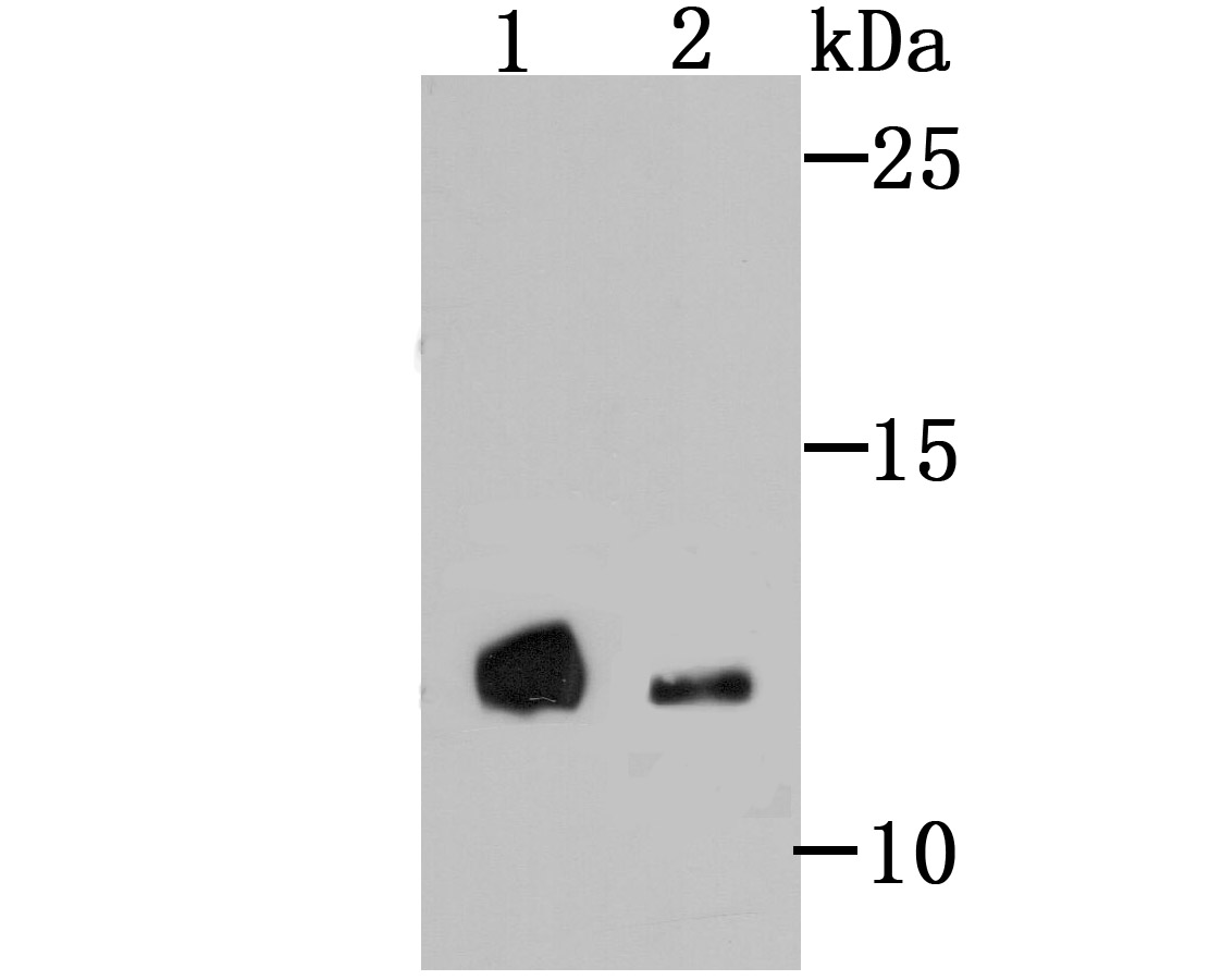 Western blot analysis of 4E-BP1 on different lysates using anti-4E-BP1 antibody at 1/500 dilution.<br />
  Lane 1: PC-3M <br />
  Lane 2: Mouse placenta tissue