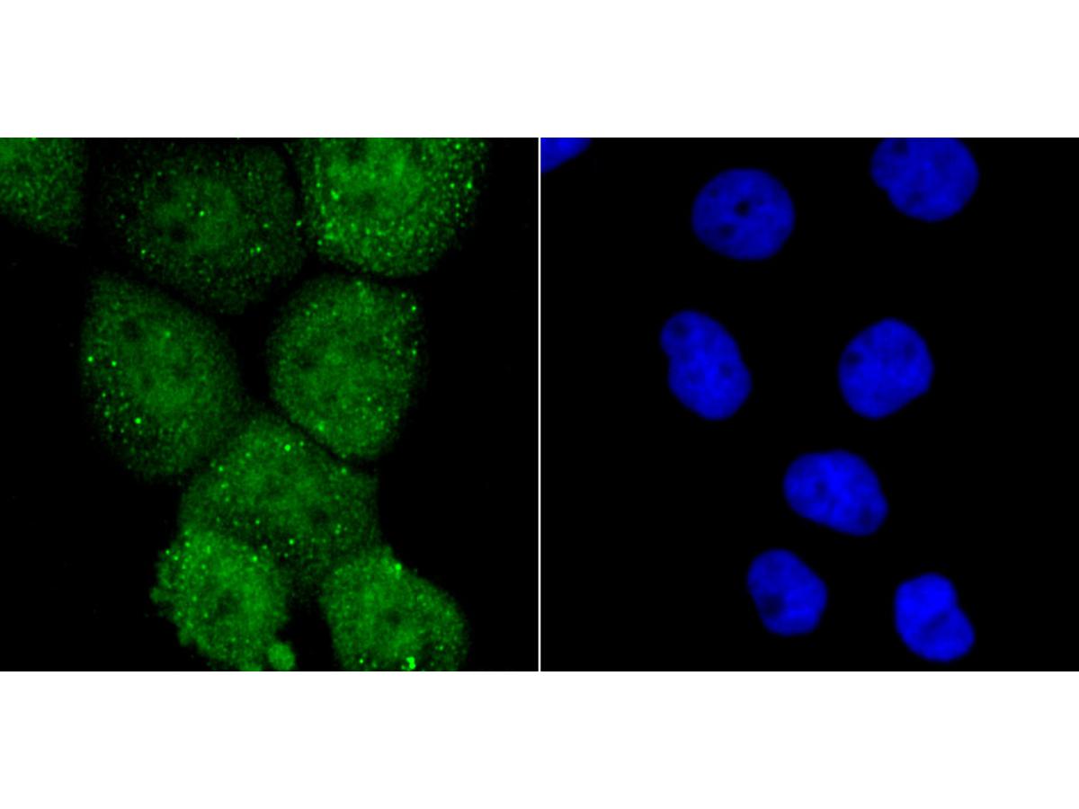 ICC staining PKA C-alpha in A431 cells (green). The nuclear counter stain is DAPI (blue). Cells were fixed in paraformaldehyde, permeabilised with 0.25% Triton X100/PBS.