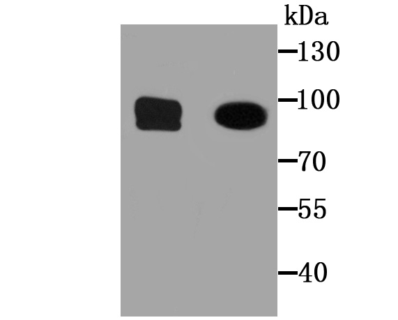 Western blot analysis of CD34 on TF-1 cell (1) and human brain tissue (2) lysates using anti-CD34 antibody at 1/1,000 dilution.