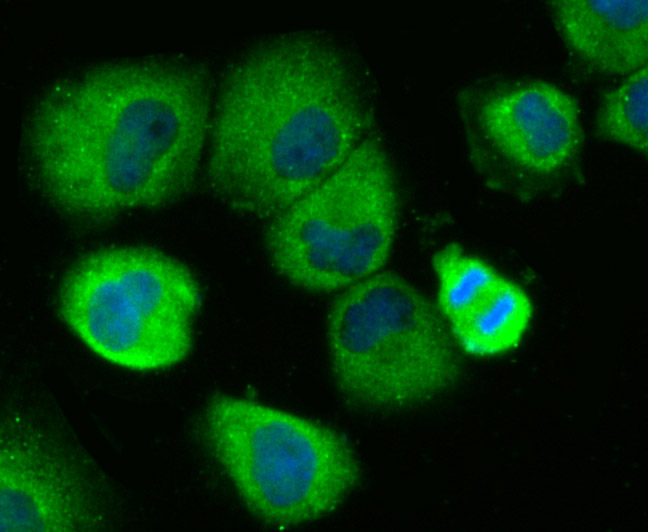 ICC staining IL-8 in HUVEC cells (green). The nuclear counter stain is DAPI (blue). Cells were fixed in paraformaldehyde, permeabilised with 0.25% Triton X100/PBS.