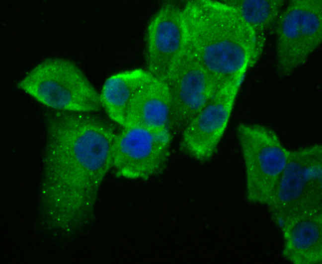 ICC staining IL-8 in PANC-1 cells (green). The nuclear counter stain is DAPI (blue). Cells were fixed in paraformaldehyde, permeabilised with 0.25% Triton X100/PBS.