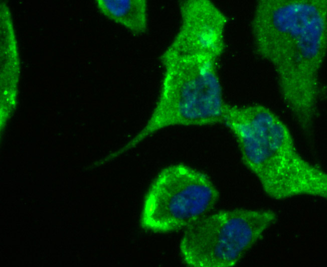 ICC staining IL-8 in PC-3M cells (green). The nuclear counter stain is DAPI (blue). Cells were fixed in paraformaldehyde, permeabilised with 0.25% Triton X100/PBS.