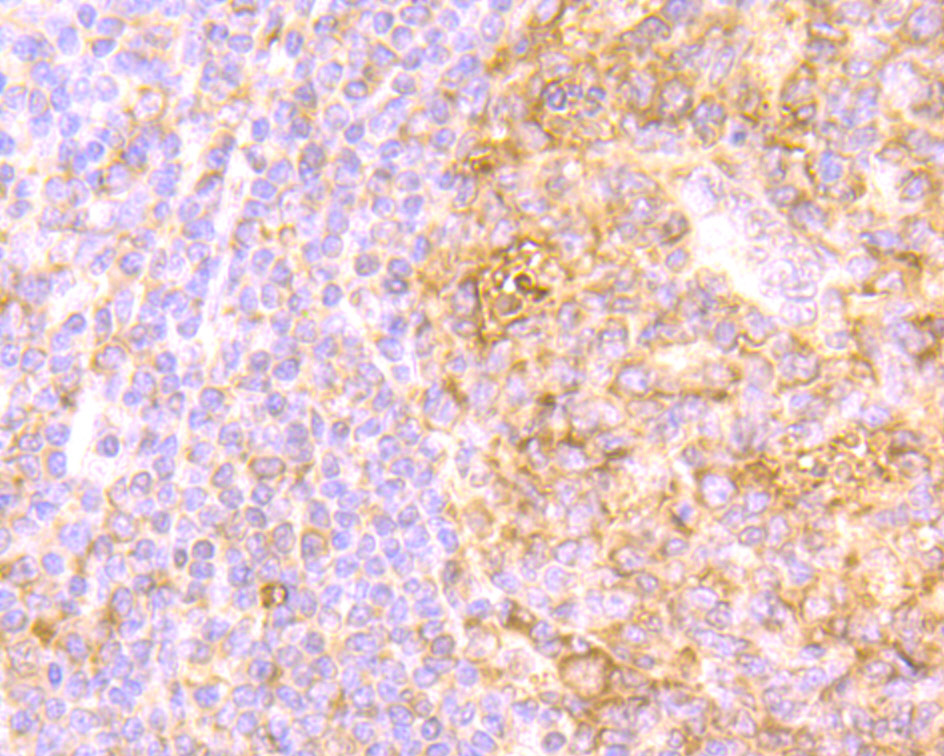 Immunohistochemical analysis of paraffin-embedded human tonsil tissue using anti-IL-8 antibody. Counter stained with hematoxylin.