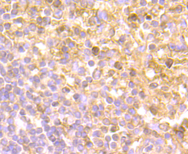 Immunohistochemical analysis of paraffin-embedded human spleen tissue using anti-IL-8 antibody. Counter stained with hematoxylin.