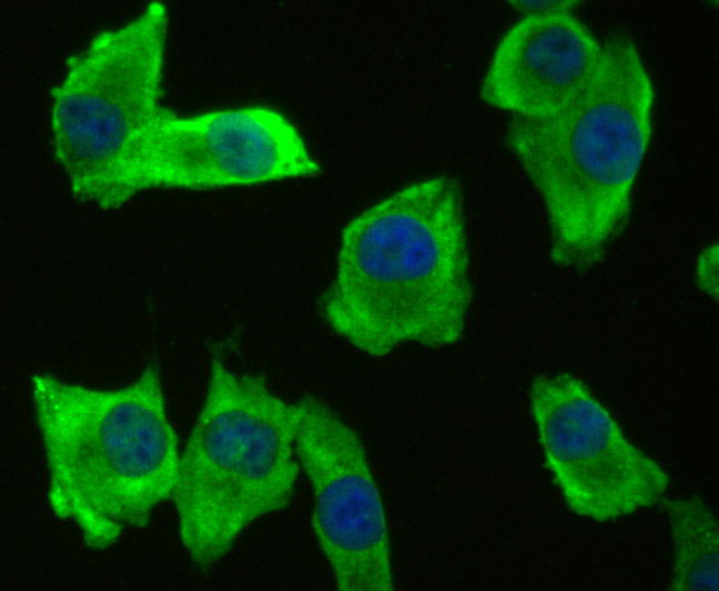 ICC staining BMAL1 in A549 cells (green). The nuclear counter stain is DAPI (blue). Cells were fixed in paraformaldehyde, permeabilised with 0.25% Triton X100/PBS.