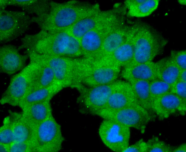 ICC staining BMAL1 in MCF-7 cells (green). The nuclear counter stain is DAPI (blue). Cells were fixed in paraformaldehyde, permeabilised with 0.25% Triton X100/PBS.