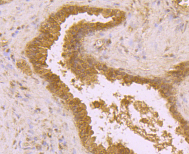Immunohistochemical analysis of paraffin-embedded human prostate tissue using anti-BMAL1 antibody. Counter stained with hematoxylin.