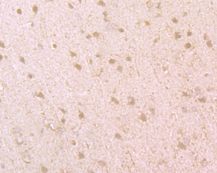 Immunohistochemical analysis of paraffin-embedded rat brain tissue using anti-BMAL1 antibody. Counter stained with hematoxylin.