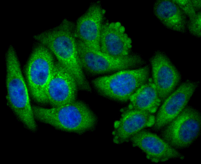 ICC staining NLRP3 in HepG2 cells (green). The nuclear counter stain is DAPI (blue). Cells were fixed in paraformaldehyde, permeabilised with 0.25% Triton X100/PBS.