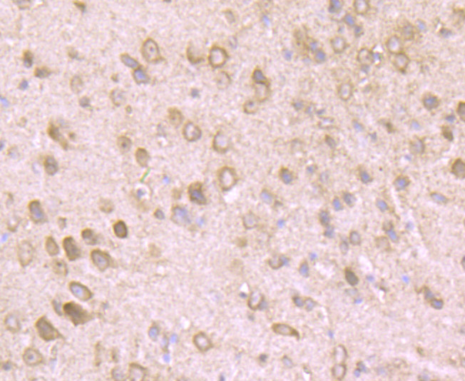 Immunohistochemical analysis of paraffin-embedded mouse brain tissue using anti-NLRP3 antibody. Counter stained with hematoxylin.