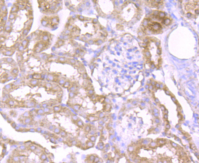 Immunohistochemical analysis of paraffin-embedded mouse kidney tissue using anti-NLRP3 antibody. Counter stained with hematoxylin.