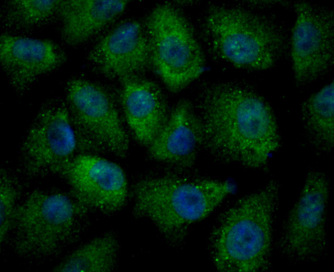 ICC staining ULK1 in A549 cells (green). The nuclear counter stain is DAPI (blue). Cells were fixed in paraformaldehyde, permeabilised with 0.25% Triton X100/PBS.