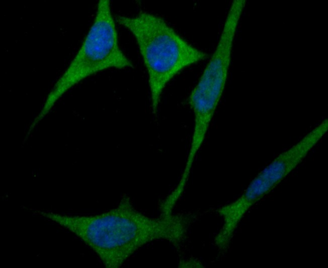 ICC staining ULK1 in SH-SY5Y cells (green). The nuclear counter stain is DAPI (blue). Cells were fixed in paraformaldehyde, permeabilised with 0.25% Triton X100/PBS.