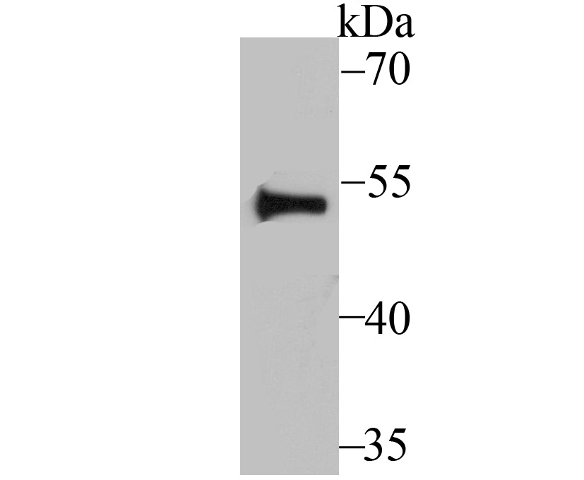 Western blot analysis of Fyn on HUVEC cell using anti-Fyn antibody at 1/200 dilution.