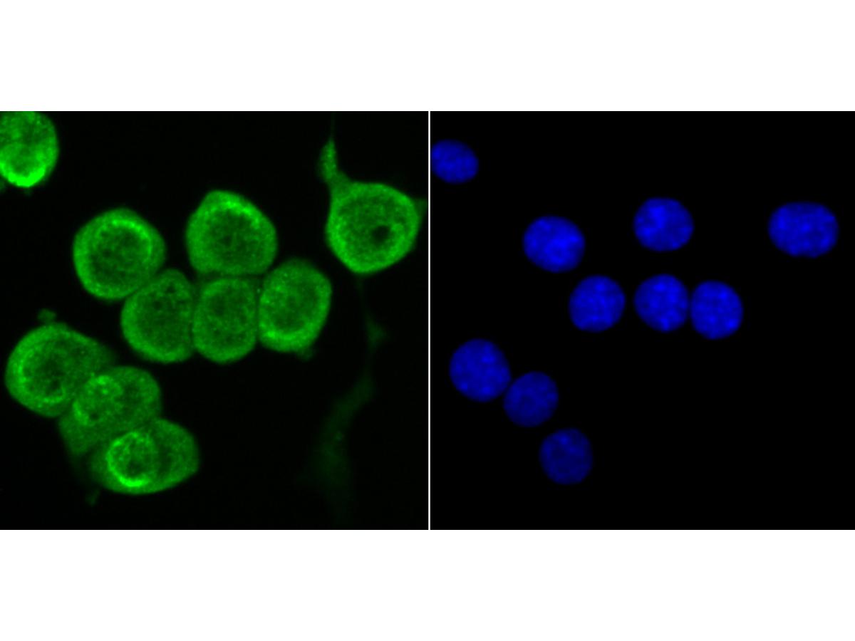 ICC staining Fyn in N2A cells (green). The nuclear counter stain is DAPI (blue). Cells were fixed in paraformaldehyde, permeabilised with 0.25% Triton X100/PBS.