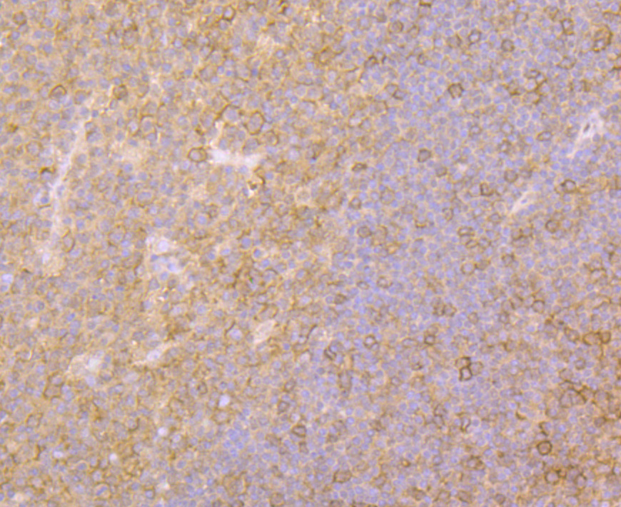 Immunohistochemical analysis of paraffin-embedded human tonsil tissue using anti-Fyn antibody. Counter stained with hematoxylin.