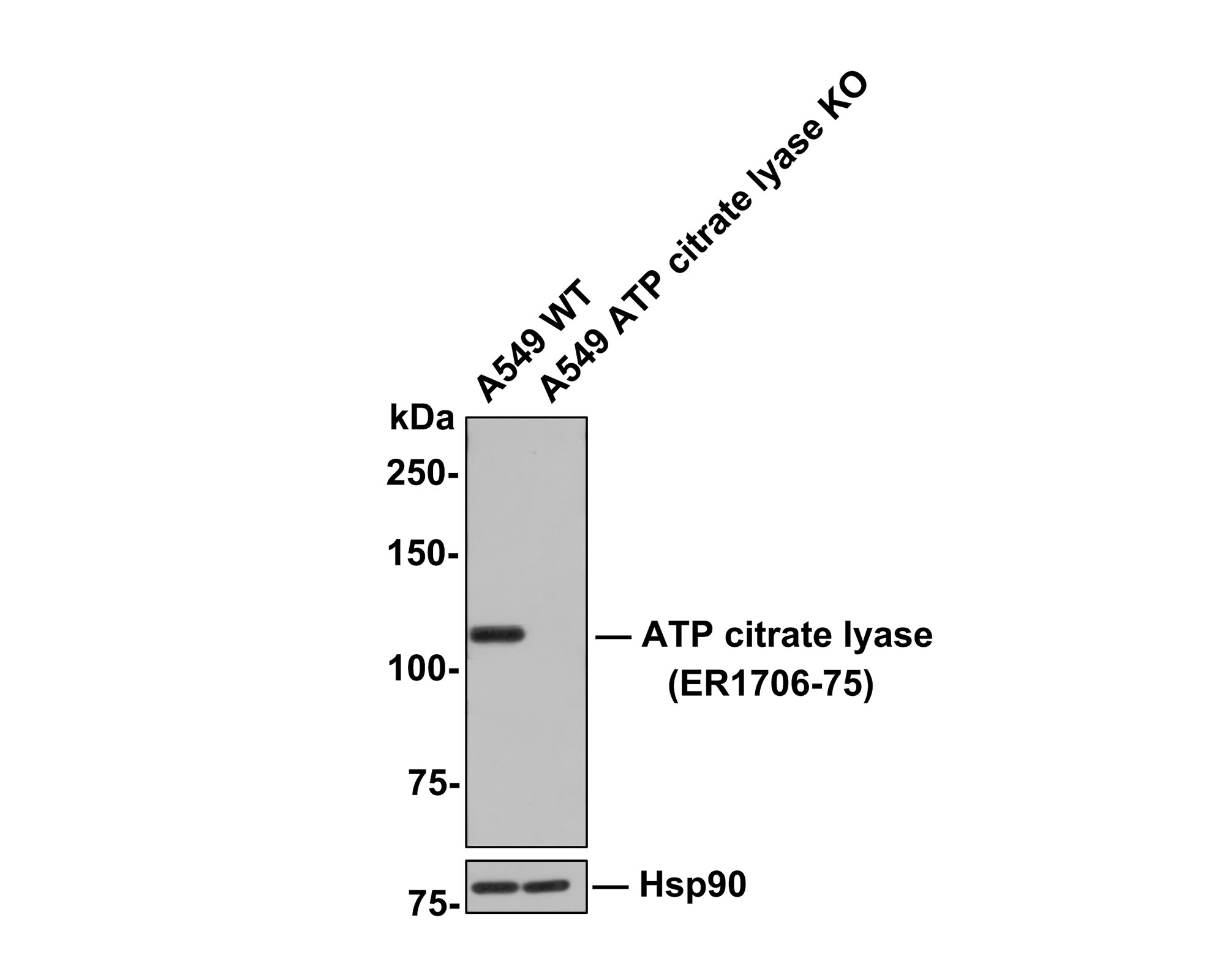 All lanes: Western blot analysis of ATP citrate lyase with anti-ATP citrate lyase antibody (ER1706-75) at 1:500 dilution.<br />
Lane 1: Wild-type A549 whole cell lysate (10 µg).<br />
Lane 2: ATP citrate lyase knockout A549 whole cell lysate (10 µg).<br />
<br />
ER1706-75 was shown to specifically react with ATP citrate lyase in wild-type A549 cells. No band was observed when ATP citrate lyase knockout sample was tested. Wild-type and ATP citrate lyase knockout samples were subjected to SDS-PAGE. Proteins were transferred to a PVDF membrane and blocked with 5% NFDM in TBST for 1 hour at room temperature. The primary antibody (ER1706-75, 1:500) was used in 5% BSA at room temperature for 2 hours. Goat Anti-Rabbit IgG-HRP Secondary Antibody (HA1001) at 1:300,000 dilution was used for 1 hour at room temperature.