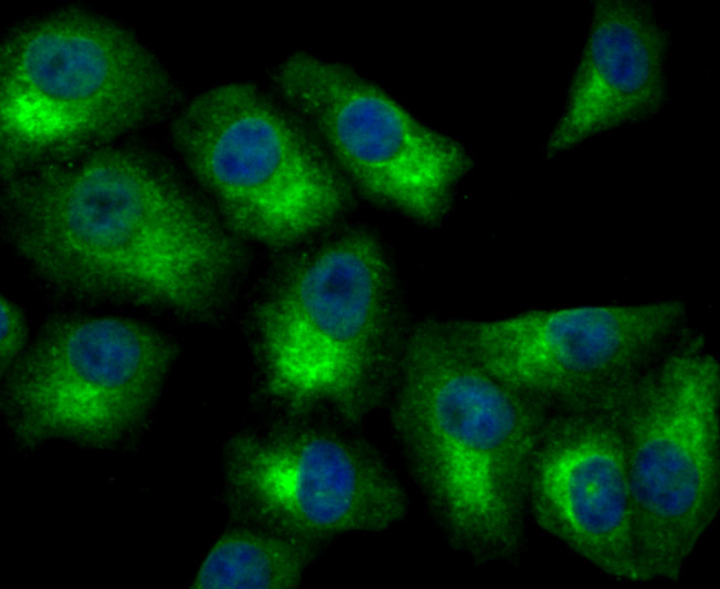 ICC staining ATP citrate lyase in A549 cells (green). The nuclear counter stain is DAPI (blue). Cells were fixed in paraformaldehyde, permeabilised with 0.25% Triton X100/PBS.