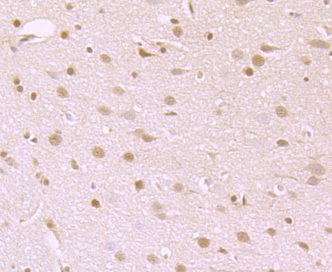 Immunohistochemical analysis of paraffin-embedded rat brain tissue using anti-ATP citrate lyase antibody. Counter stained with hematoxylin.