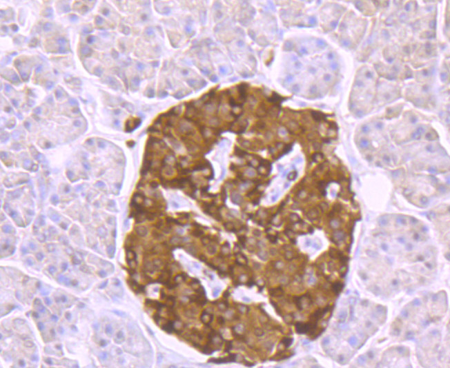 Immunohistochemical analysis of paraffin-embedded human pancreas tissue using anti-ATP citrate lyase antibody. Counter stained with hematoxylin.