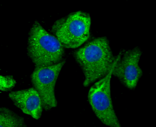 ICC staining MMP-3 in A549 cells (green). The nuclear counter stain is DAPI (blue). Cells were fixed in paraformaldehyde, permeabilised with 0.25% Triton X100/PBS.