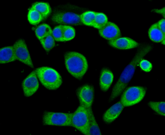 ICC staining MMP-3 in LOVO cells (green). The nuclear counter stain is DAPI (blue). Cells were fixed in paraformaldehyde, permeabilised with 0.25% Triton X100/PBS.