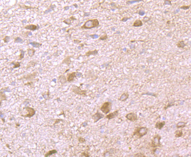 Immunohistochemical analysis of paraffin-embedded rat brain tissue using anti-MMP-3 antibody. Counter stained with hematoxylin.