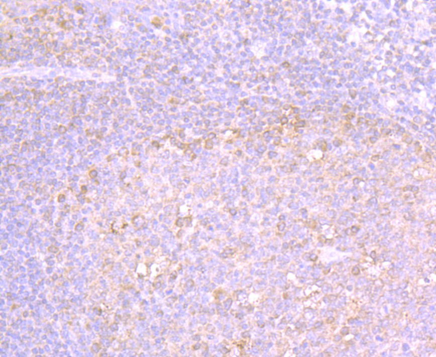 Immunohistochemical analysis of paraffin-embedded human tonsil tissue using anti-MMP-3 antibody. Counter stained with hematoxylin.