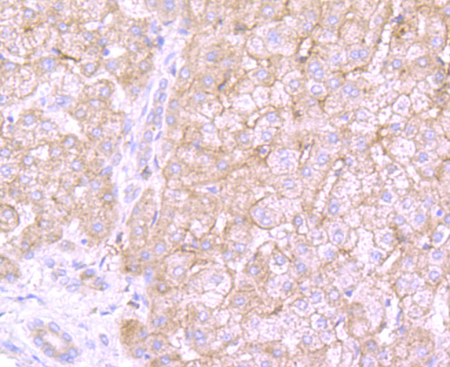Immunohistochemical analysis of paraffin-embedded human liver tissue using anti-MMP-3 antibody. Counter stained with hematoxylin.