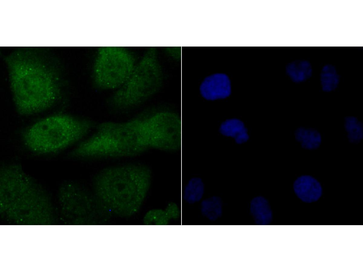 ICC staining of FBXW7 in HUVEC cells (green). Formalin fixed cells were permeabilized with 0.1% Triton X-100 in TBS for 10 minutes at room temperature and blocked with 10% negative goat serum for 15 minutes at room temperature. Cells were probed with the primary antibody (ER1706-78, 1/50) for 1 hour at room temperature, washed with PBS. Alexa Fluor®488 conjugate-Goat anti-Rabbit IgG was used as the secondary antibody at 1/1,000 dilution. The nuclear counter stain is DAPI (blue).
