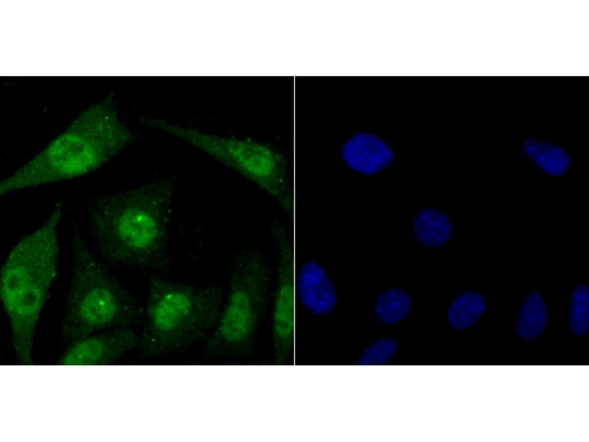 ICC staining of FBXW7 in SH-SY5Y cells (green). Formalin fixed cells were permeabilized with 0.1% Triton X-100 in TBS for 10 minutes at room temperature and blocked with 10% negative goat serum for 15 minutes at room temperature. Cells were probed with the primary antibody (ER1706-78, 1/50) for 1 hour at room temperature, washed with PBS. Alexa Fluor®488 conjugate-Goat anti-Rabbit IgG was used as the secondary antibody at 1/1,000 dilution. The nuclear counter stain is DAPI (blue).