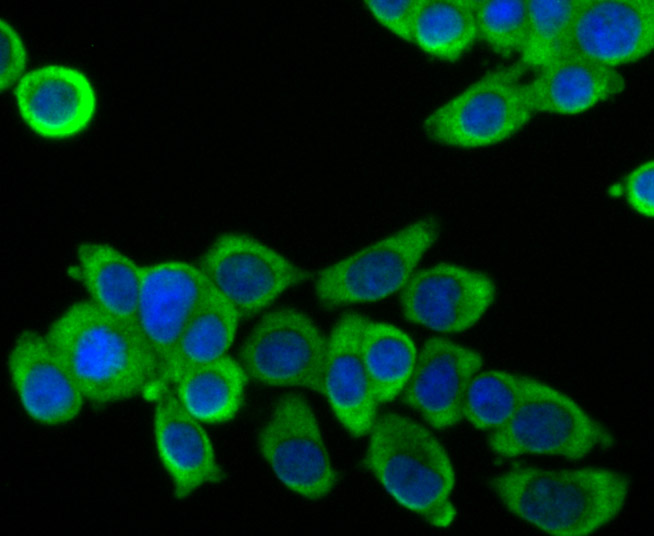 ICC staining FOXO3A in LOVO cells (green). The nuclear counter stain is DAPI (blue). Cells were fixed in paraformaldehyde, permeabilised with 0.25% Triton X100/PBS.