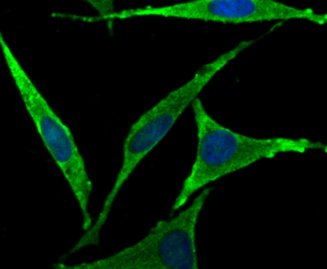 ICC staining FOXO3A in SH-SY5Y cells (green). The nuclear counter stain is DAPI (blue). Cells were fixed in paraformaldehyde, permeabilised with 0.25% Triton X100/PBS.