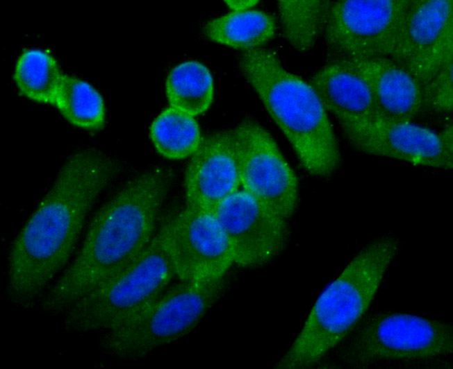 ICC staining CD4 in Hela cells (green). The nuclear counter stain is DAPI (blue). Cells were fixed in paraformaldehyde, permeabilised with 0.25% Triton X100/PBS.