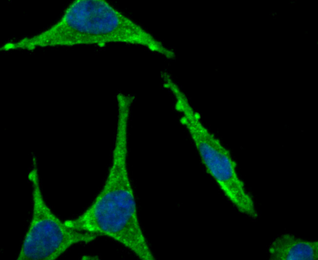 ICC staining CD4 in HepG2 cells (green). The nuclear counter stain is DAPI (blue). Cells were fixed in paraformaldehyde, permeabilised with 0.25% Triton X100/PBS.