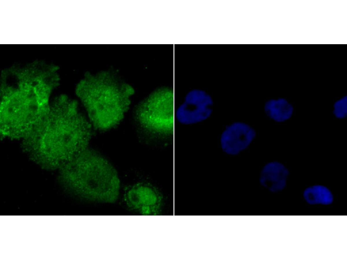 ICC staining RAR alpha in A431 cells (green). The nuclear counter stain is DAPI (blue). Cells were fixed in paraformaldehyde, permeabilised with 0.25% Triton X100/PBS.