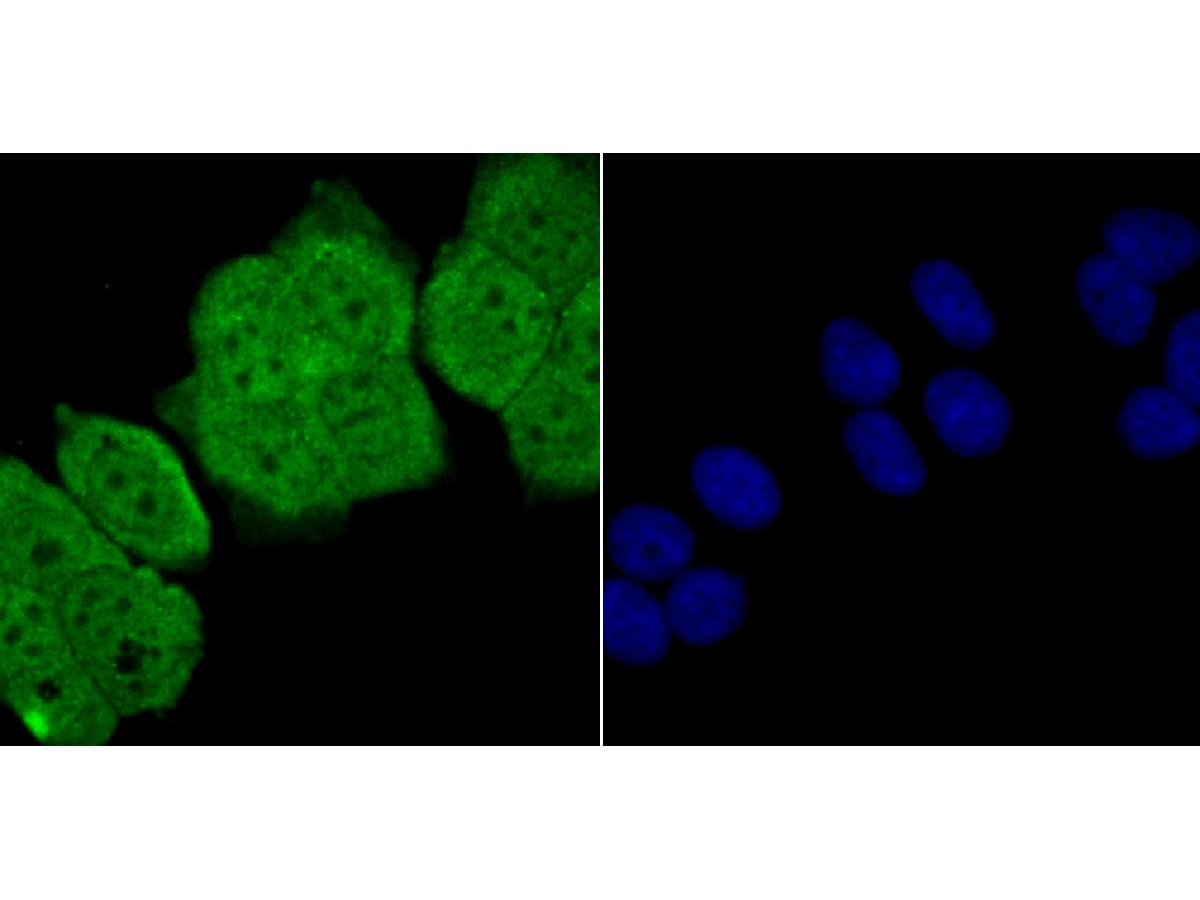 ICC staining RAR alpha in MCF-7 cells (green). The nuclear counter stain is DAPI (blue). Cells were fixed in paraformaldehyde, permeabilised with 0.25% Triton X100/PBS.