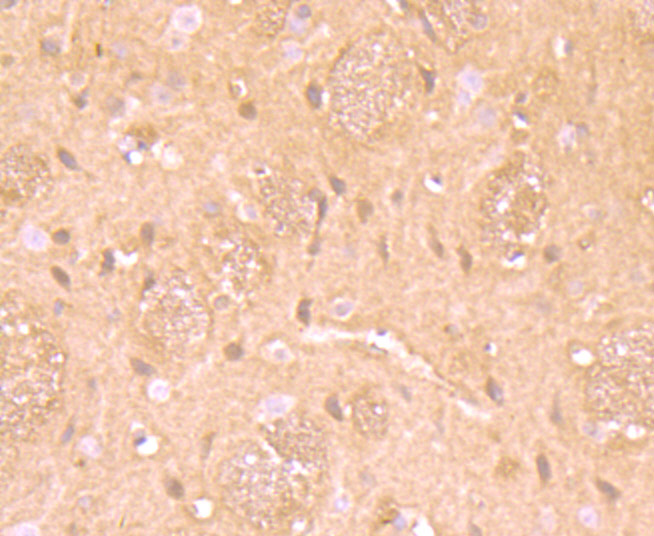 Immunohistochemical analysis of paraffin-embedded rat brain tissue using anti-RAR alpha antibody. Counter stained with hematoxylin.