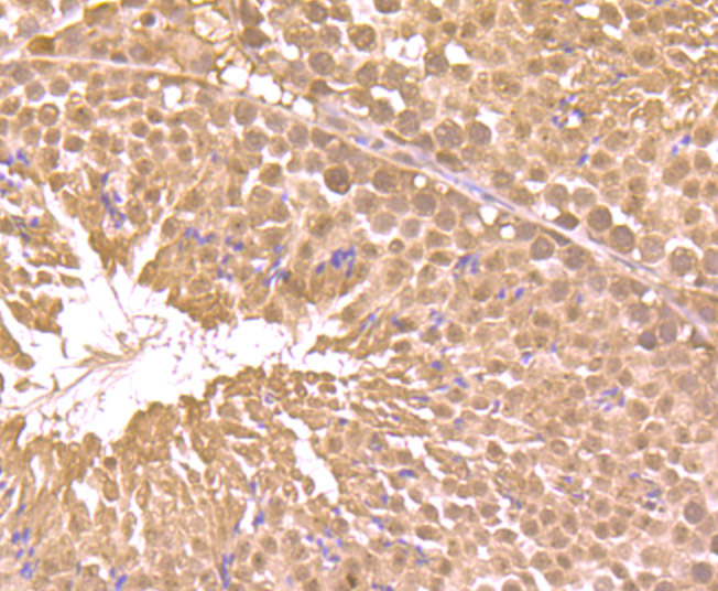 Immunohistochemical analysis of paraffin-embedded mouse testis tissue using anti-RAR alpha antibody. Counter stained with hematoxylin.