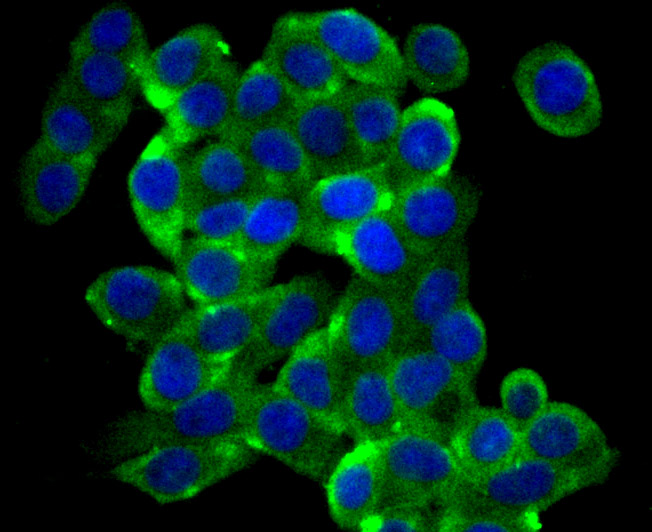 ICC staining GAPDH in LOVO cells (green). The nuclear counter stain is DAPI (blue). Cells were fixed in paraformaldehyde, permeabilised with 0.25% Triton X100/PBS.